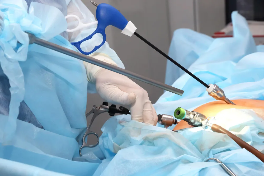 Laparoscopic Surgery